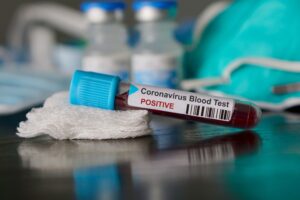 Coronavirus, un test del sangue verifica la positività in 15 minuti