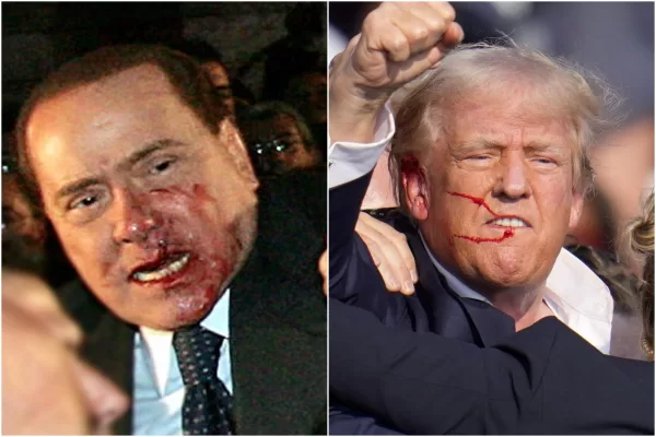 Trump, Berlusconi e il volto insanguinato, il corpo mediale del leader non conosce usura